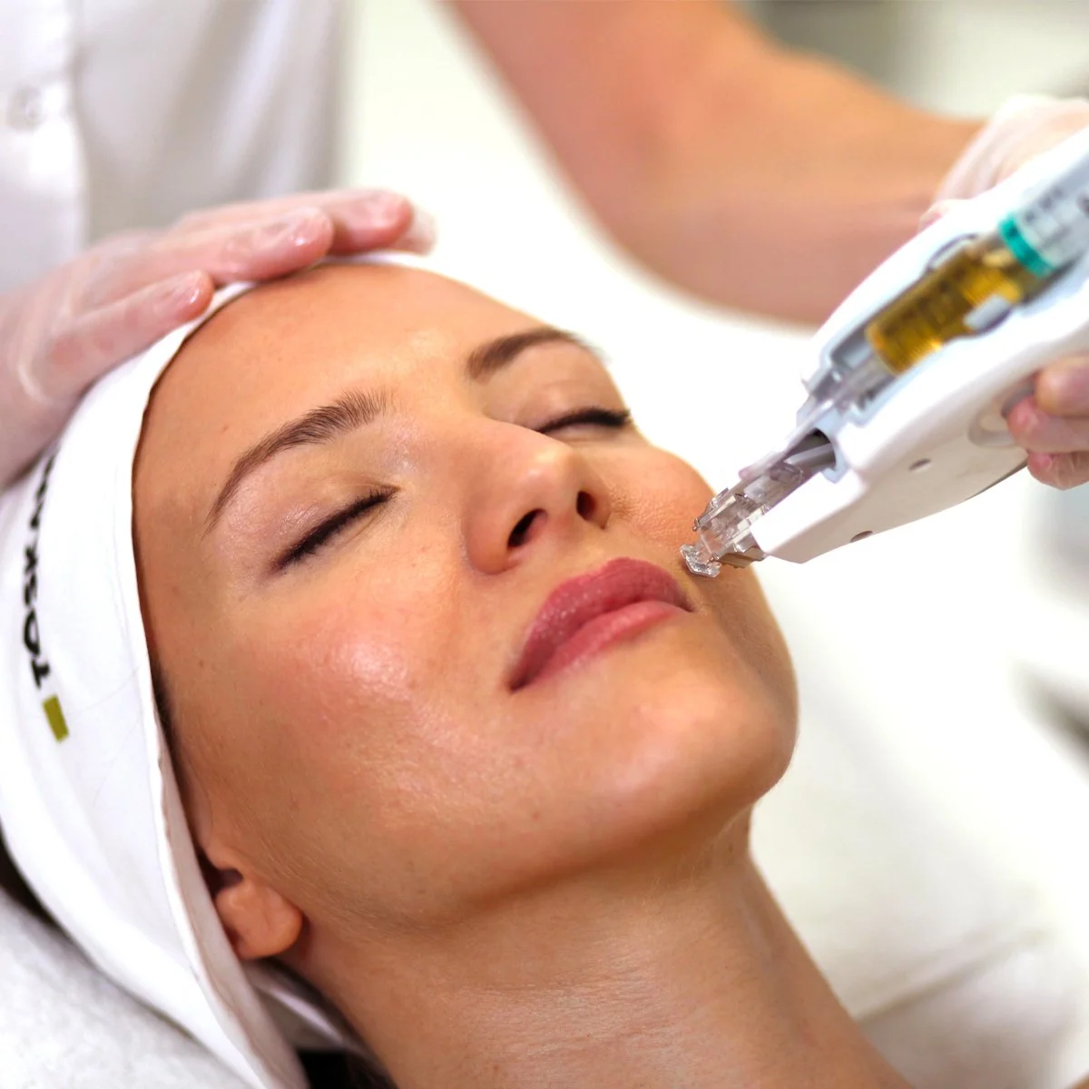 laser treatment of tkn mesoject gun at o young md in kerrville texas