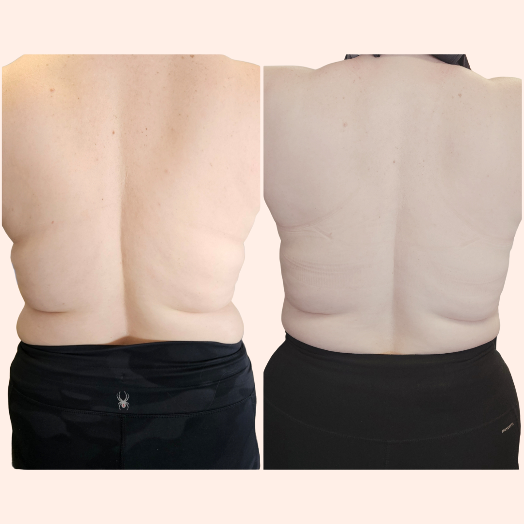 Squlpt Your Way: Understanding the Body Shaping Revolution