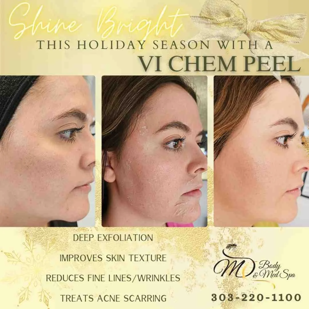 Firm and Fabulous: Collagen Boosting Treatments You Need