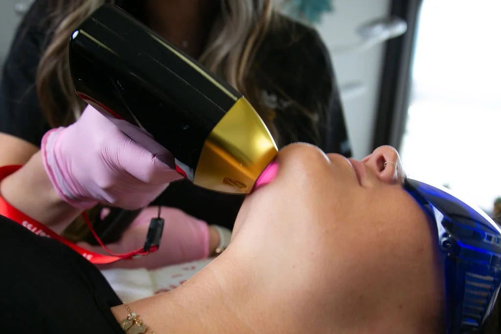 A person receiving laser hair removal treatment on their face by a technician wearing pink gloves.