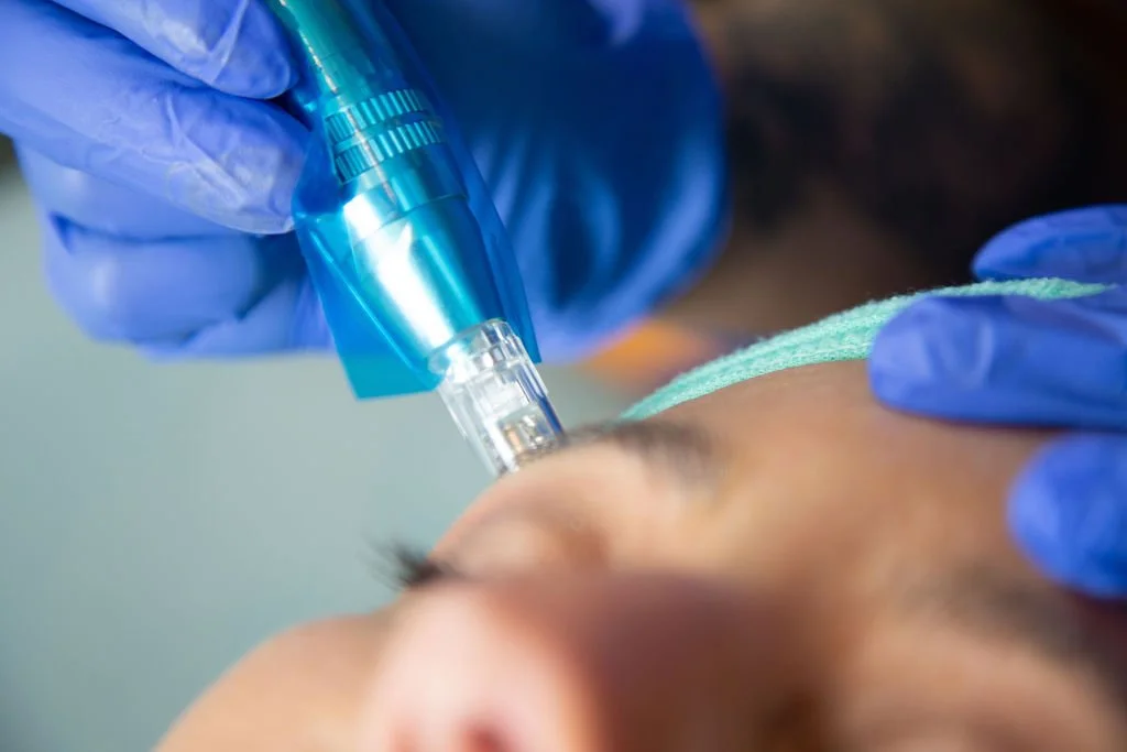 A person receiving a cosmetic or medical procedure on their forehead, performed by a professional wearing blue gloves using a small handheld device.