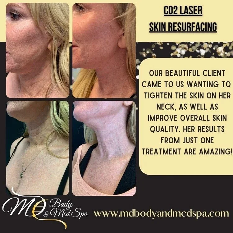 www.mdbodyandmedspa.com-1.jpg