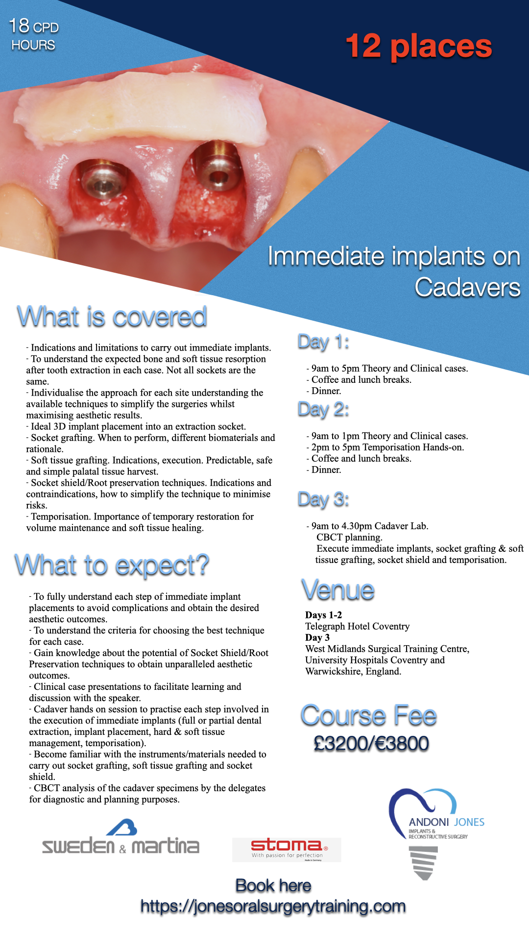 Immediate implant course APRIL27.002.png