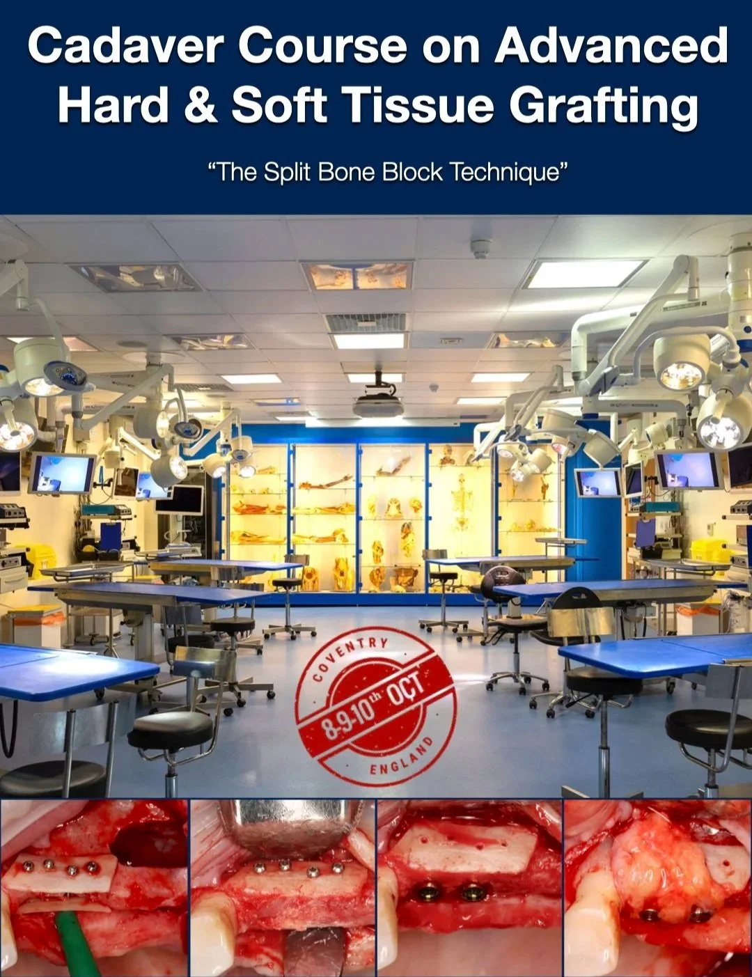 CADAVER COURSE ON ADVANCED HARD & SOFT TISSUE GRAFTING