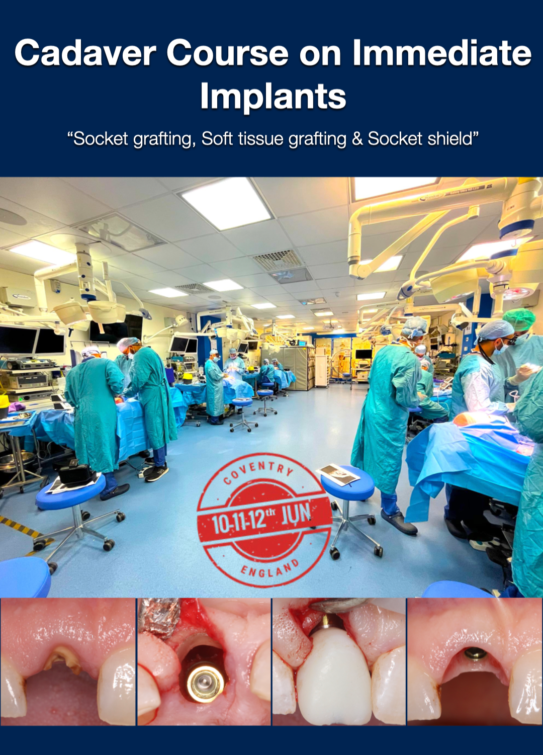 CADAVER COURSE ON IMMEDIATE IMPLANTS