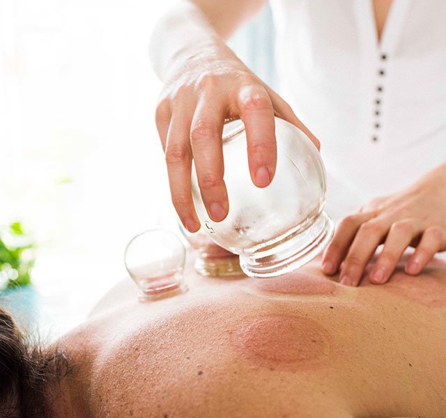 Cupping Therapy