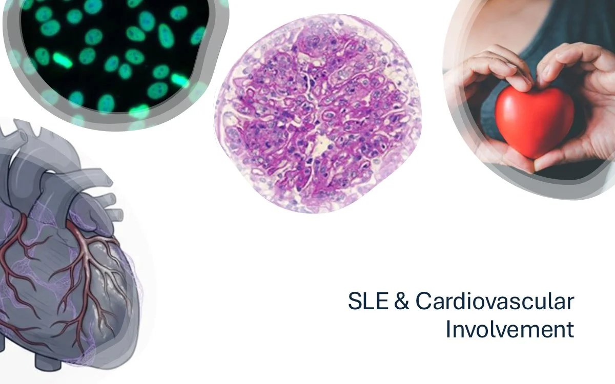 Lupus and Your Heart: What Patients and Families Should Know