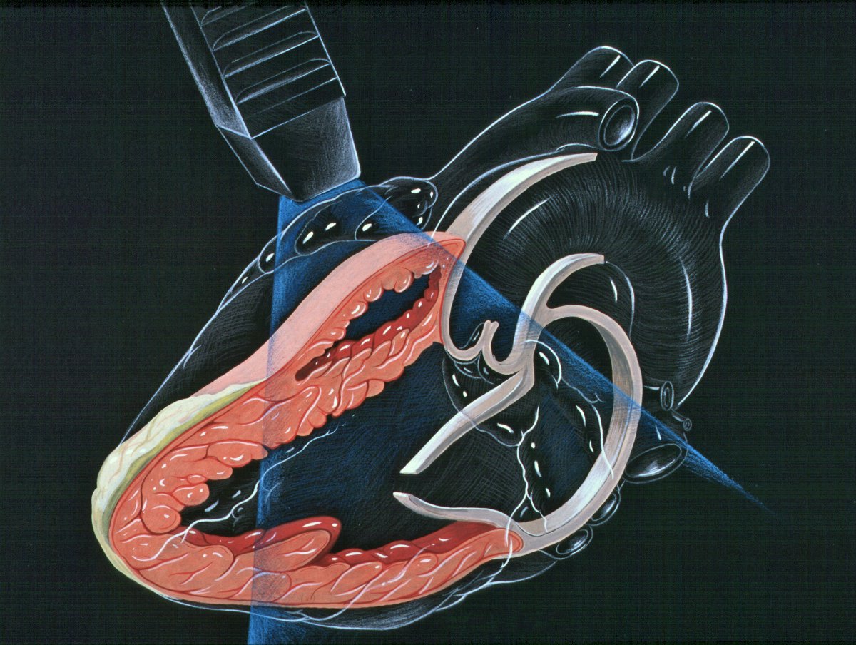 Heart_lpla_echocardiography_diagram.jpg