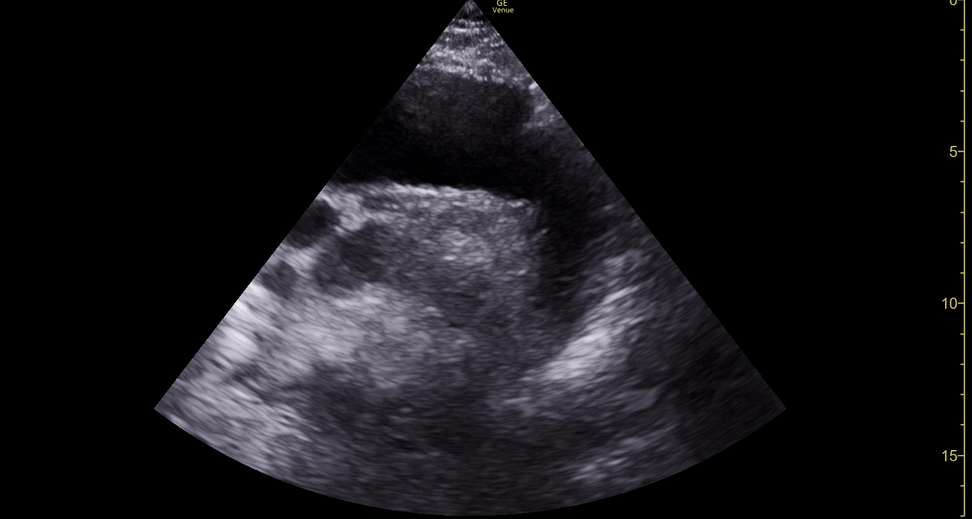 further aortic arch.gif