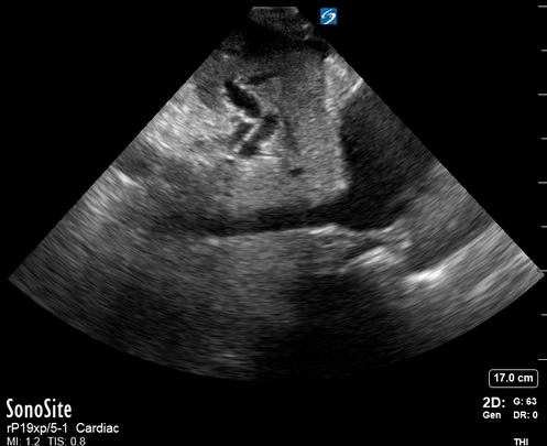 IVC.gif