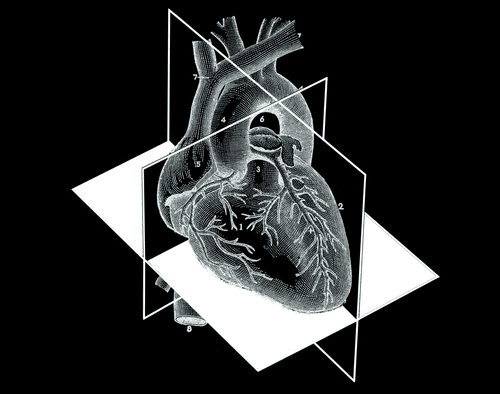 Heart: Basics — Ultra Sono