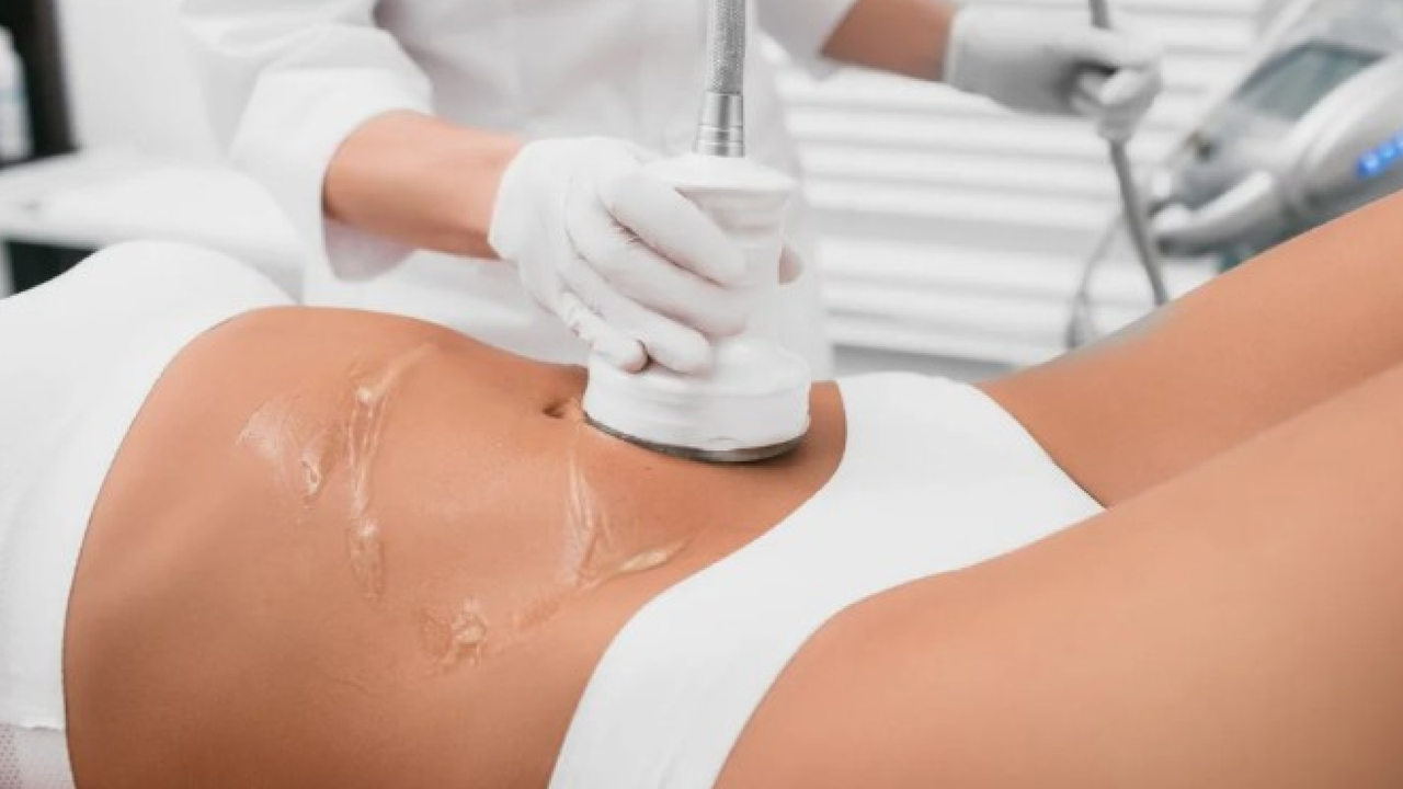 Sculpt Without Surgery: Non-Invasive Body Contouring
