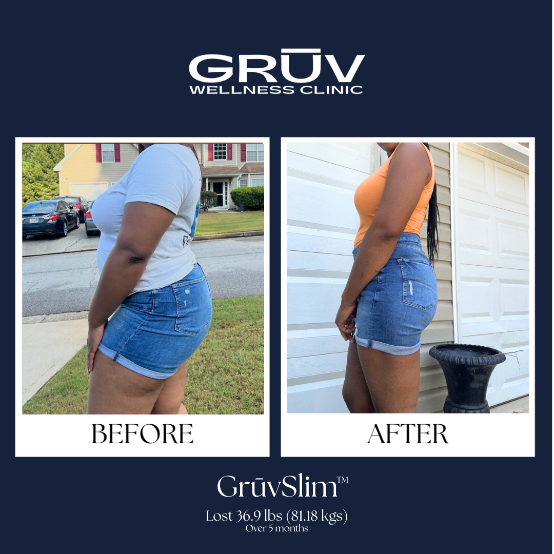 GrūvSlim™ Result JB1.png