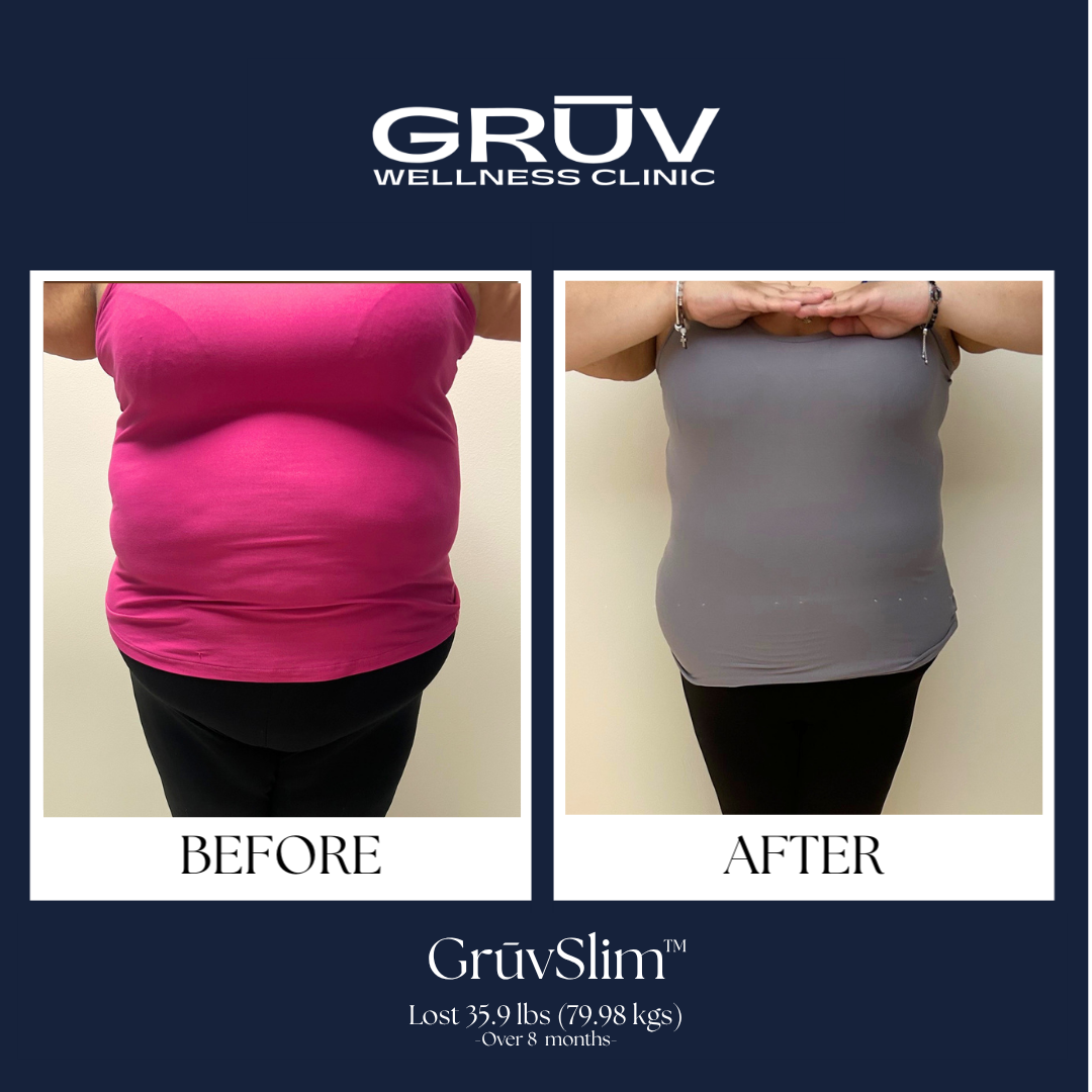 GrūvSlim™ Result SP1.png