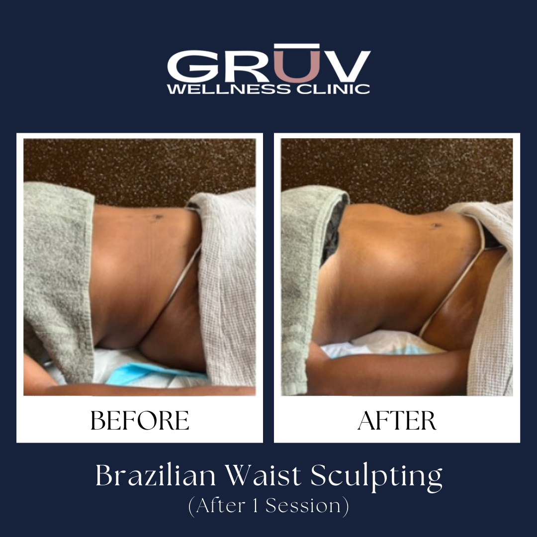 Click to view: BRAZILIAN SCULPTING RESULTS