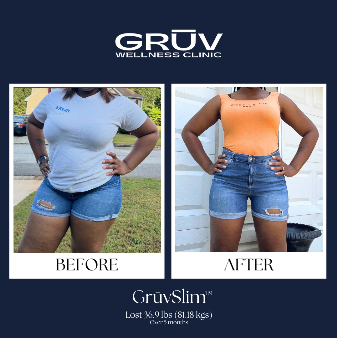 GrūvSlim™ Result JB2.png