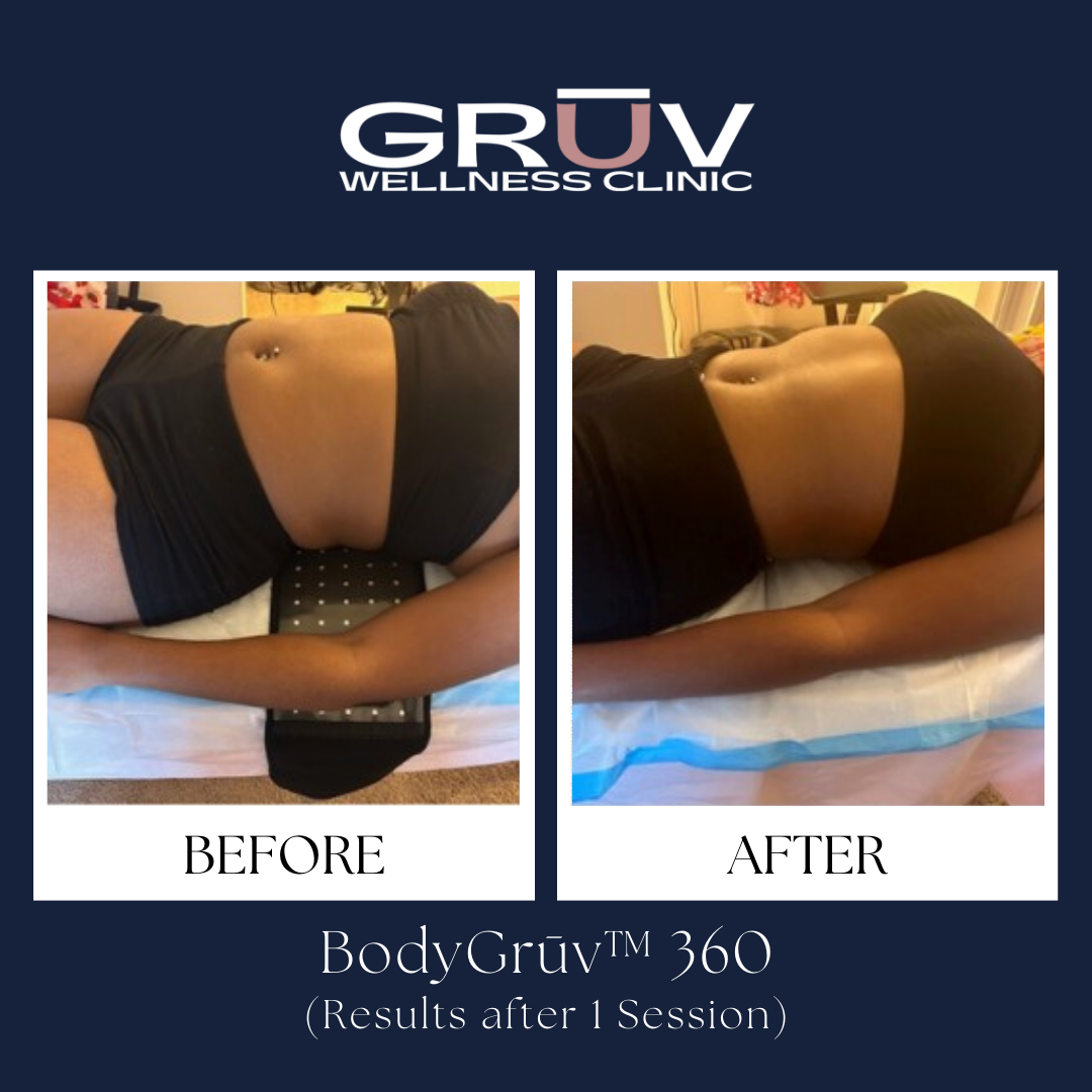 Click to view: BODY CONTOURING RESULTS