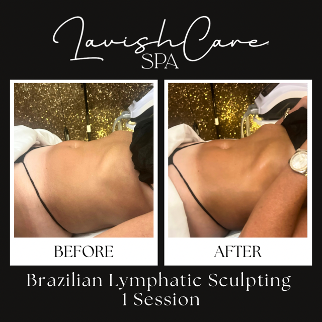 Copy of FN-MLD (1).PNG