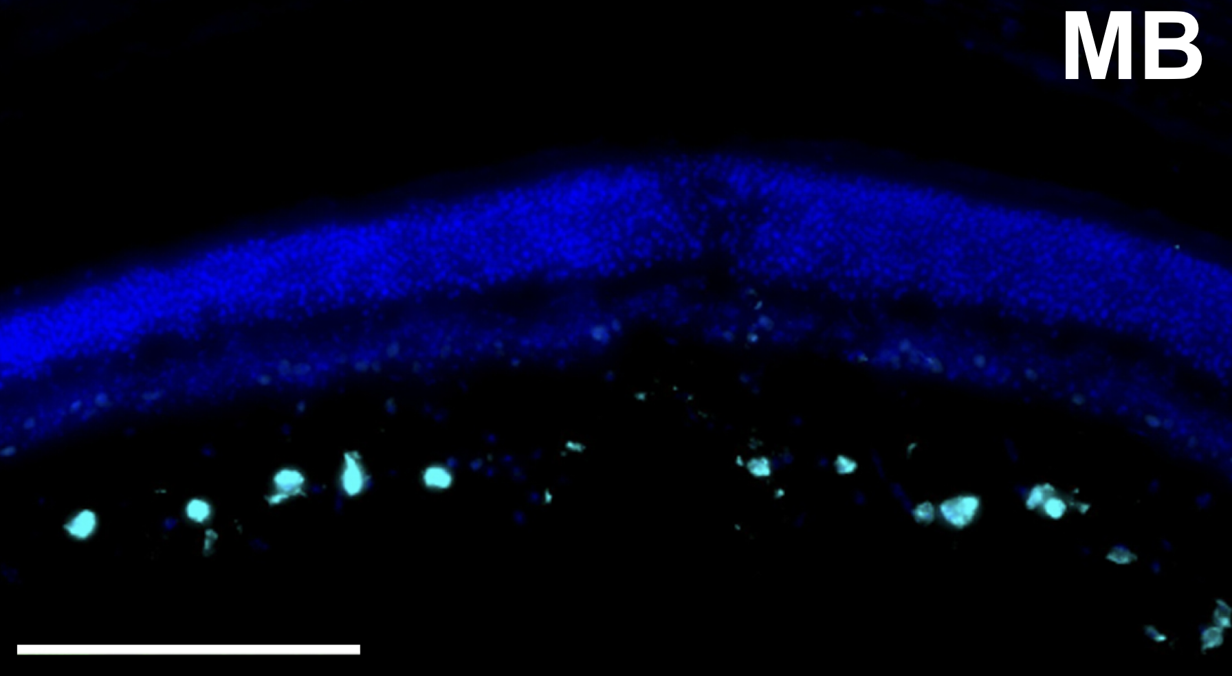 Chronic Neurodegeneration and Neurogenesis