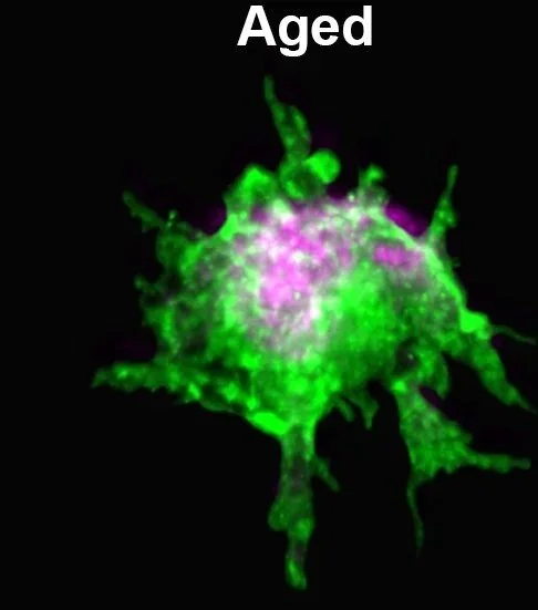 Aging and Regeneration