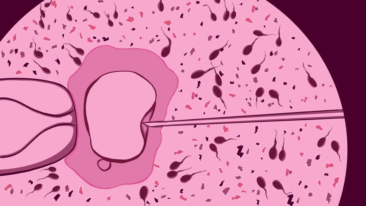 Generation Plastic and the Fertility Fallout