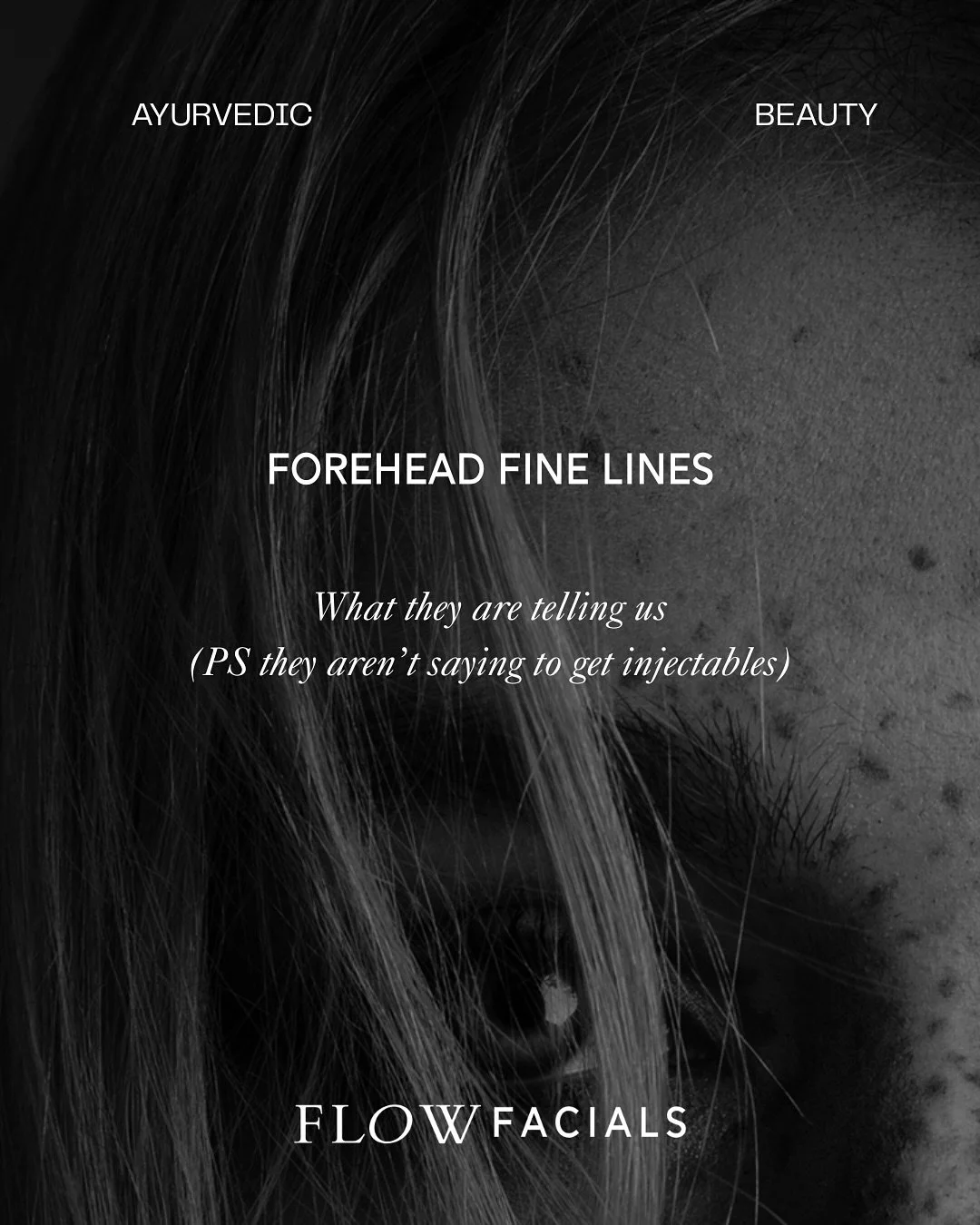 Forehead Lines 

Always an expression of something deeper. Arising at times in our lives where our output is more than how we are truly replenishing into ourselves. Also, arising at this junction in the year where fatigue begins to really set in.

To