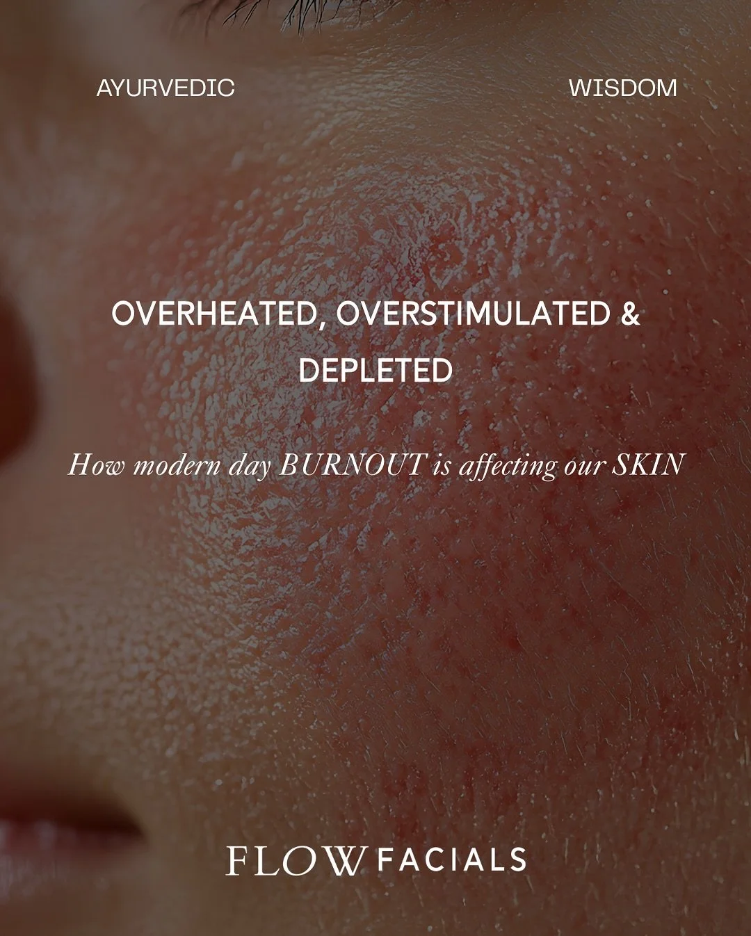 Overheated. Overstimulated. Depleted.

These can be the signposts of end of year burnout and also in perimenopausal skin imbalances. 

Our modern day lives and all the stuff that comes with that style of living can be incredibly pitta and vata aggrav