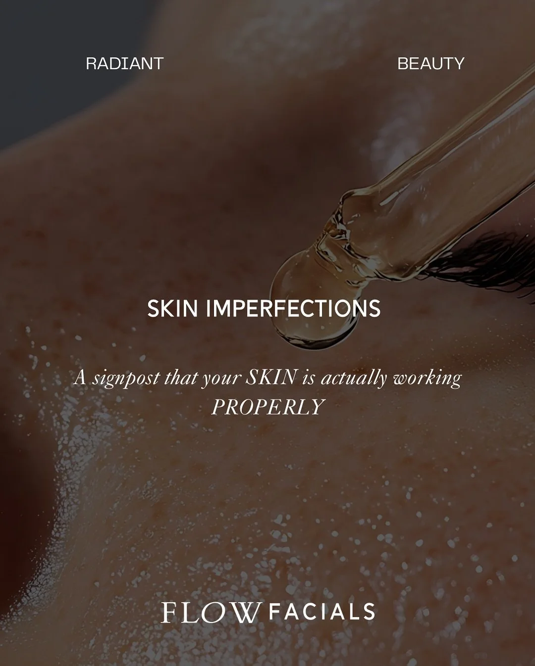 Skin Imperfections.

A reminder that your skin is actually working properly.

A gentle reminder that our skin is an elimination organ. Over our lifetime, we will experience many different imbalances that arise in our complexion. This is what happens.