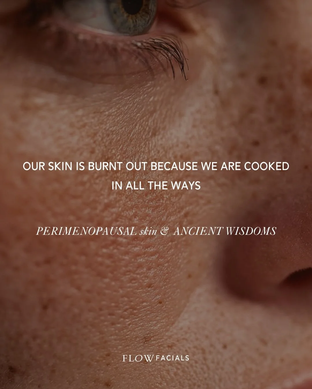 Our skin is burnt out because we are cooked in all the ways.

From an Ayurvedic beauty perspective, whenever there is excess heat in the skin, there is excess pitta energy (fire &amp; water elements).

Perimenopause is peak pitta season. A time where