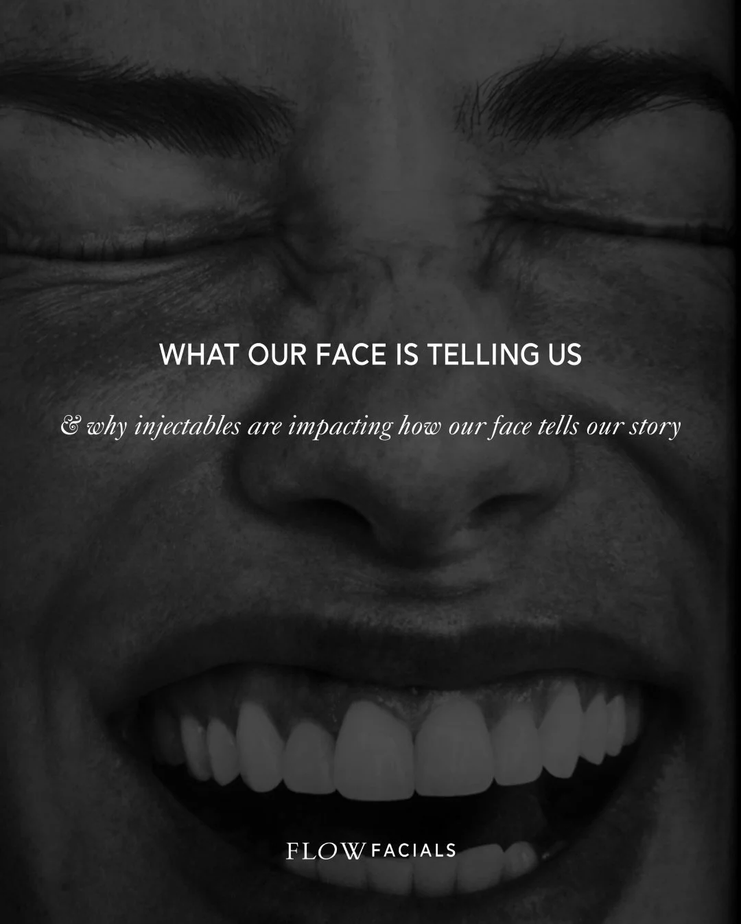 What our face is telling us&hellip;

&amp; why injectables are impacting how our face tells our story. 

Did you know that each area of our face represents areas of doshic intelligence &amp; it&rsquo;s dominance in certain areas of the body?

Ayurved