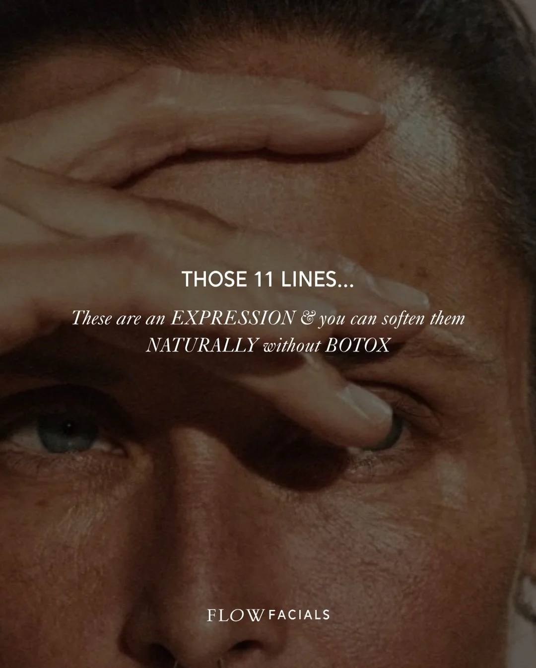 Those 11 lines. These are an expression &amp; you can soften them naturally without botox.

In Ayurvedic beauty philosophy, every line on the face is not only wisdom earnt, but an expression of some form of physical, emotional, mental or seasonal imb