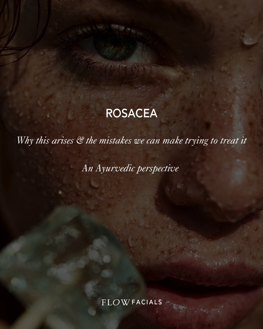 Rosacea. Why this arises &amp; the mistakes we can make trying to treat it. An Ayurvedic perspective.

This one comes up a lot on the treatment bed. It&rsquo;s no coincidence that this particular imbalance arises for women in their 40s and seems to b