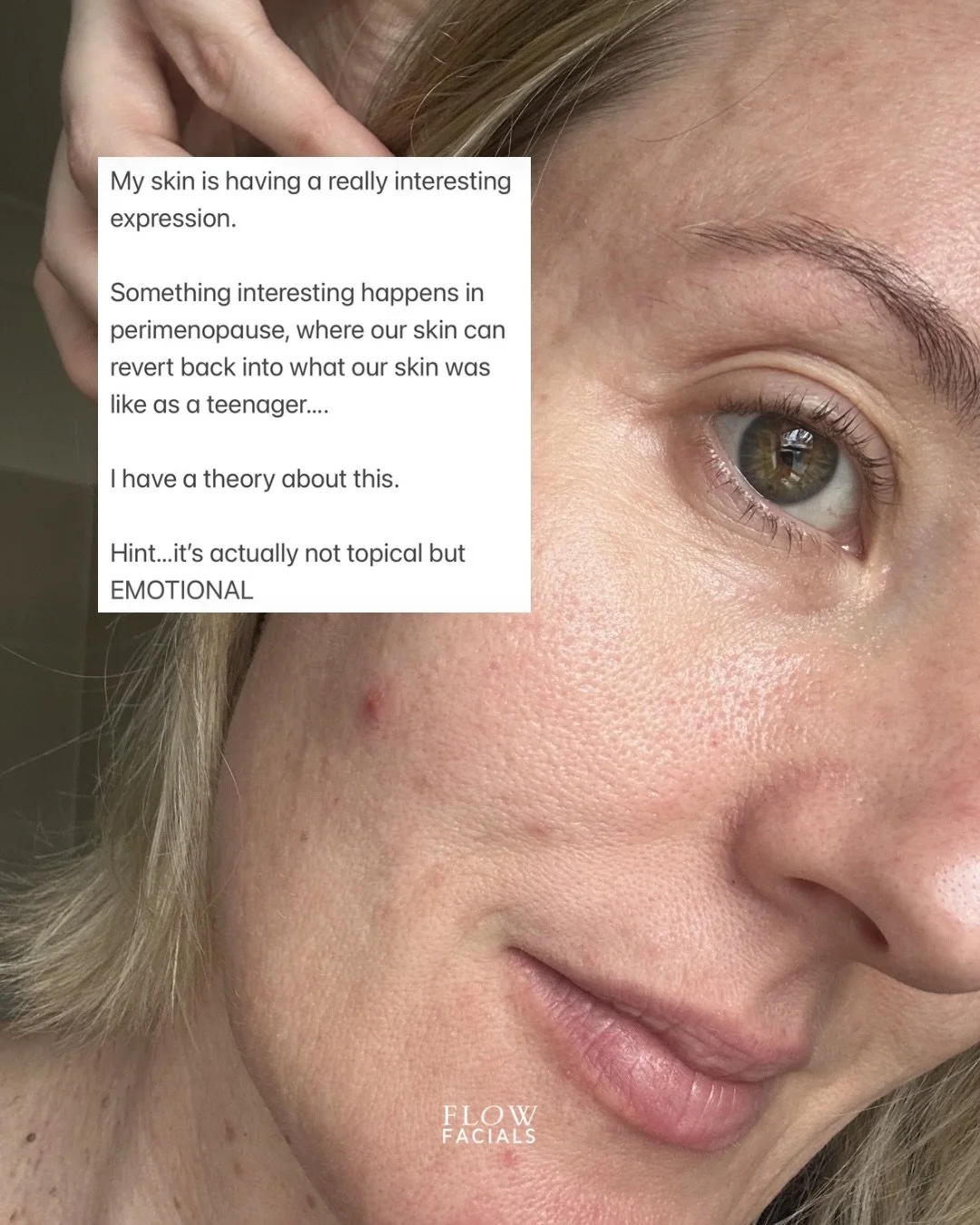 My skin is having a really interesting expression at the moment and I thought I&rsquo;d share. I believe it&rsquo;s really important to acknowledge that our skin balance &amp; radiance is a big part of our emotional balance. 

Something interesting h