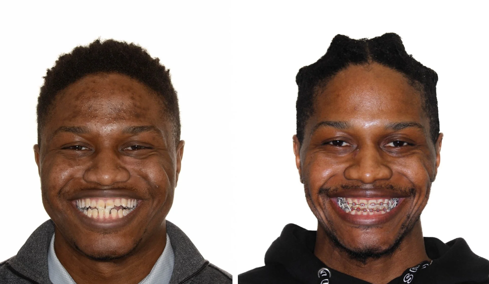 orthognathic-surgery-long-island.jpg