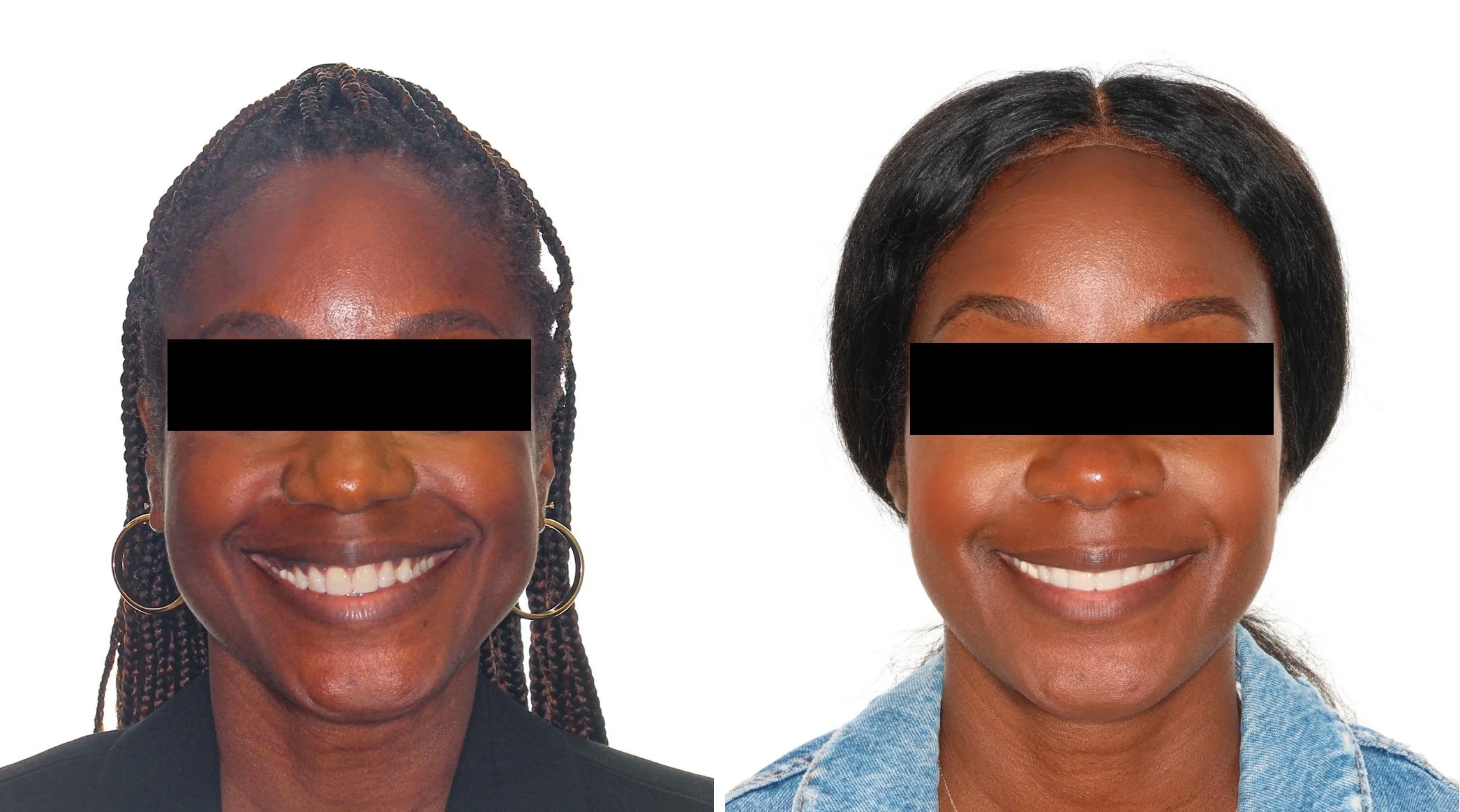 facial-asymmetry-correction.jpg