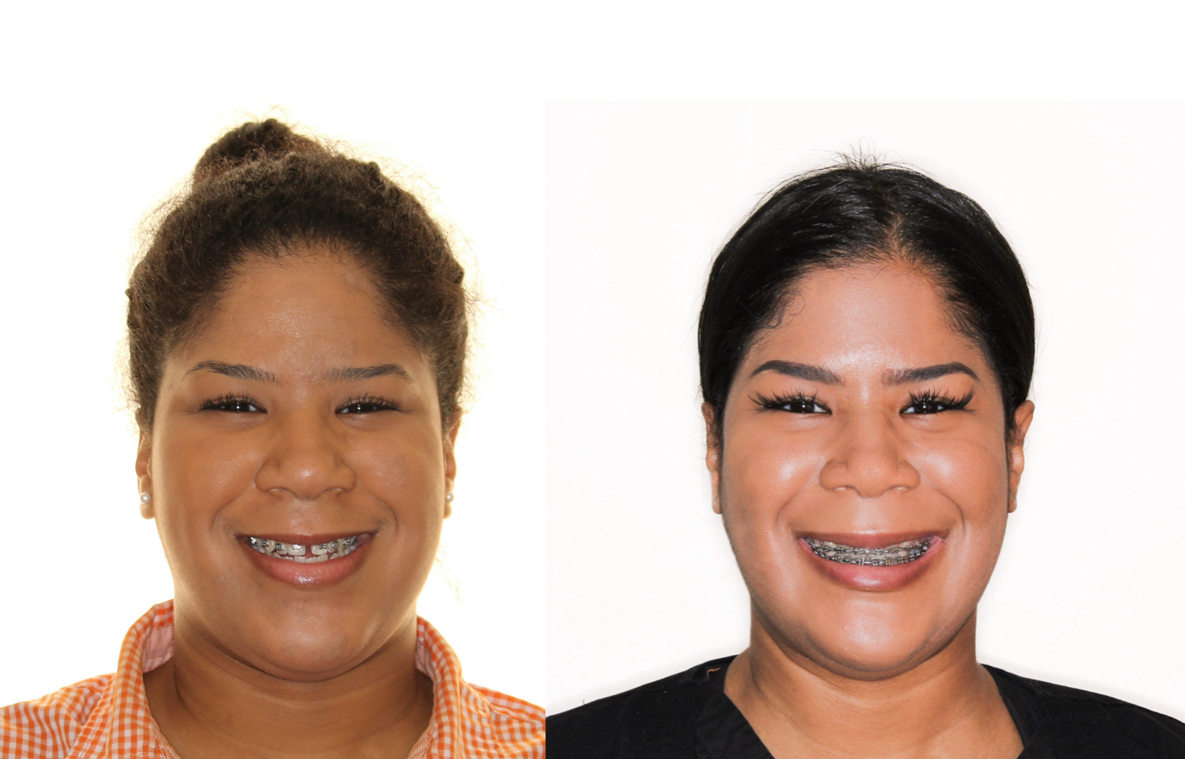 Class 3 correction.png