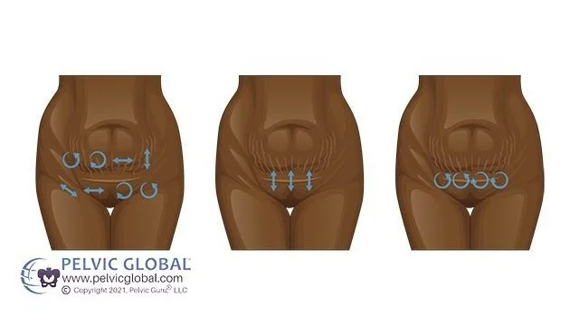 Navigating C-Section Scar Recovery with Insightful Tips and Support; Image from Pelvic Guru