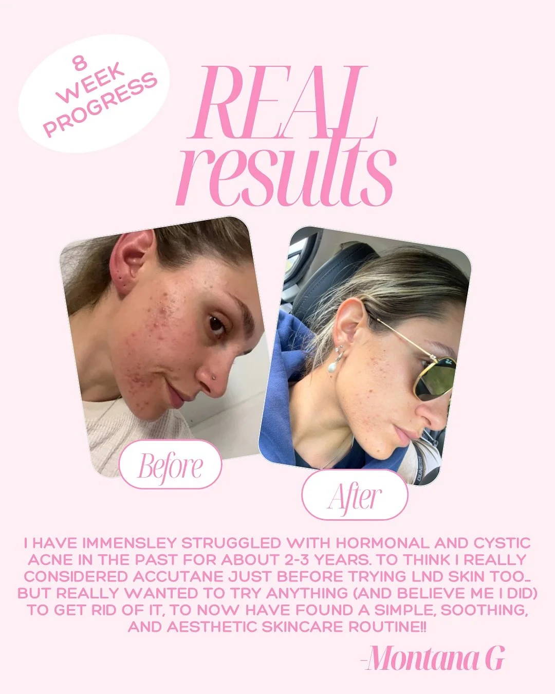 We are beyond proud of the beautiful Montana&rsquo;s results after 8 weeks of using LND SKIN! It was such a sweet emotional testimony to read (we couldn&rsquo;t fit it all in here) &amp; we could not be happier that our community is loving our natura