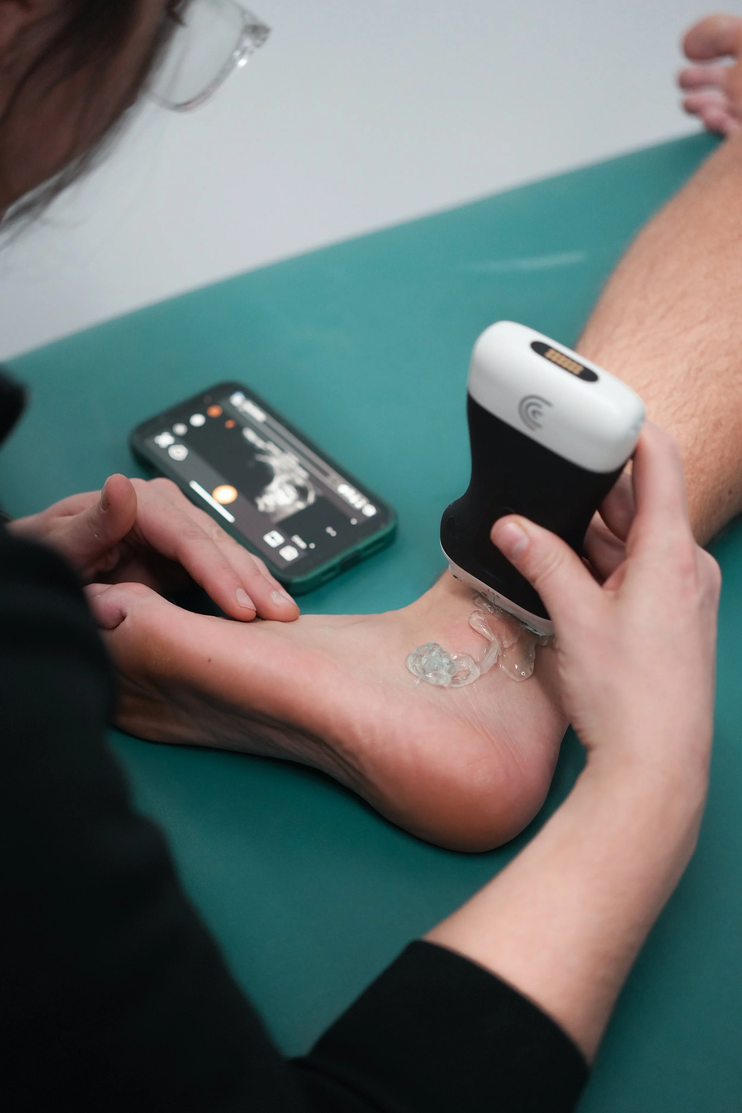 How Ultrasound Helps Runners Recover from Tendon Injuries Faster