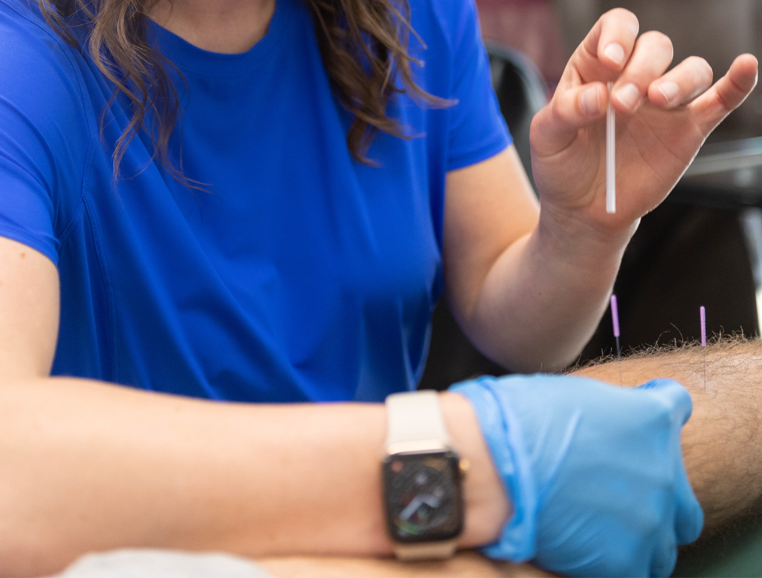 Treatment Tuesday -  Dry Needling with Dr. Emily 