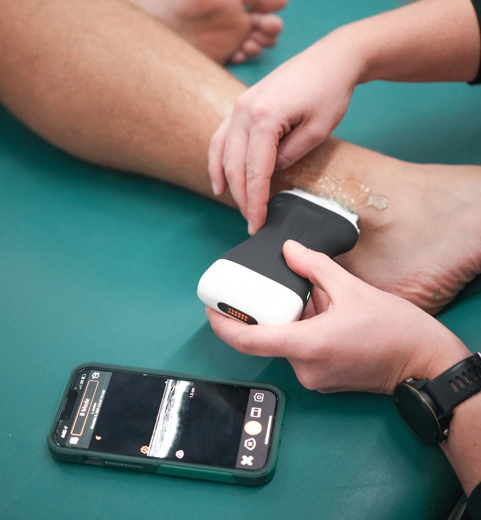 Treatment Tuesday - Diagnostic Ultrasound with Dr. Emily