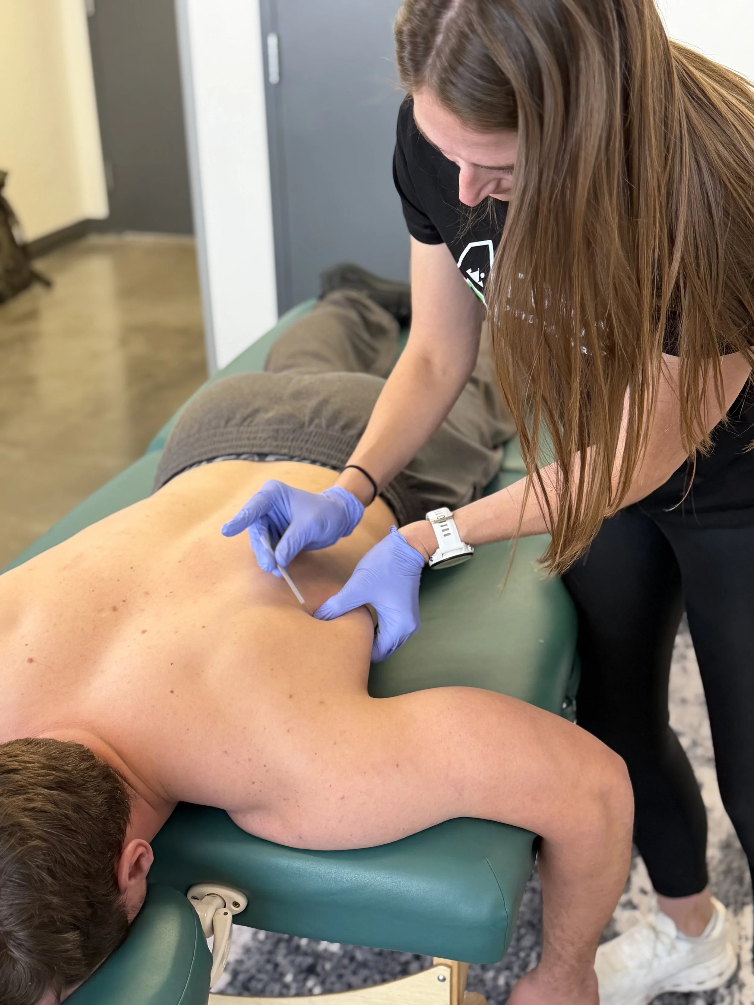 Dry Needling Demo at Fleet Feet