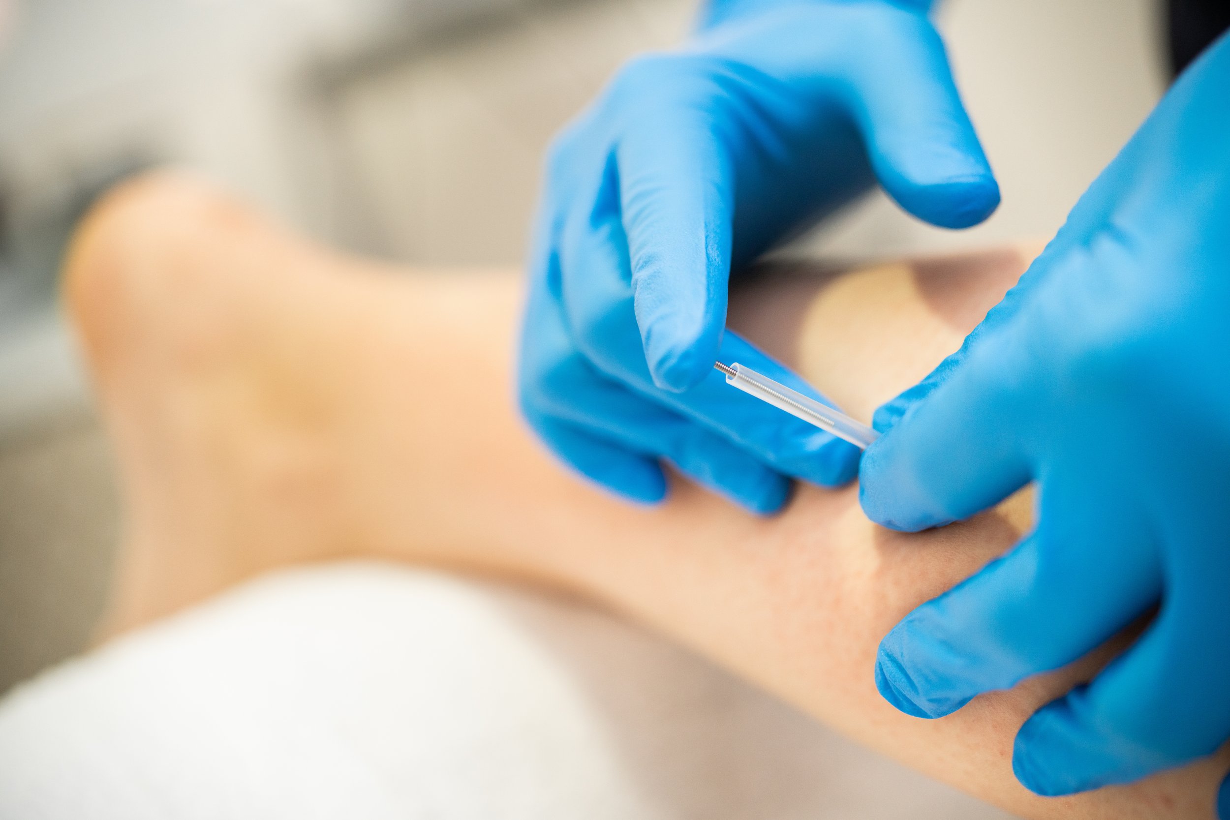 Healthcare professional wearing blue gloves administering an injection into a patient's arm.