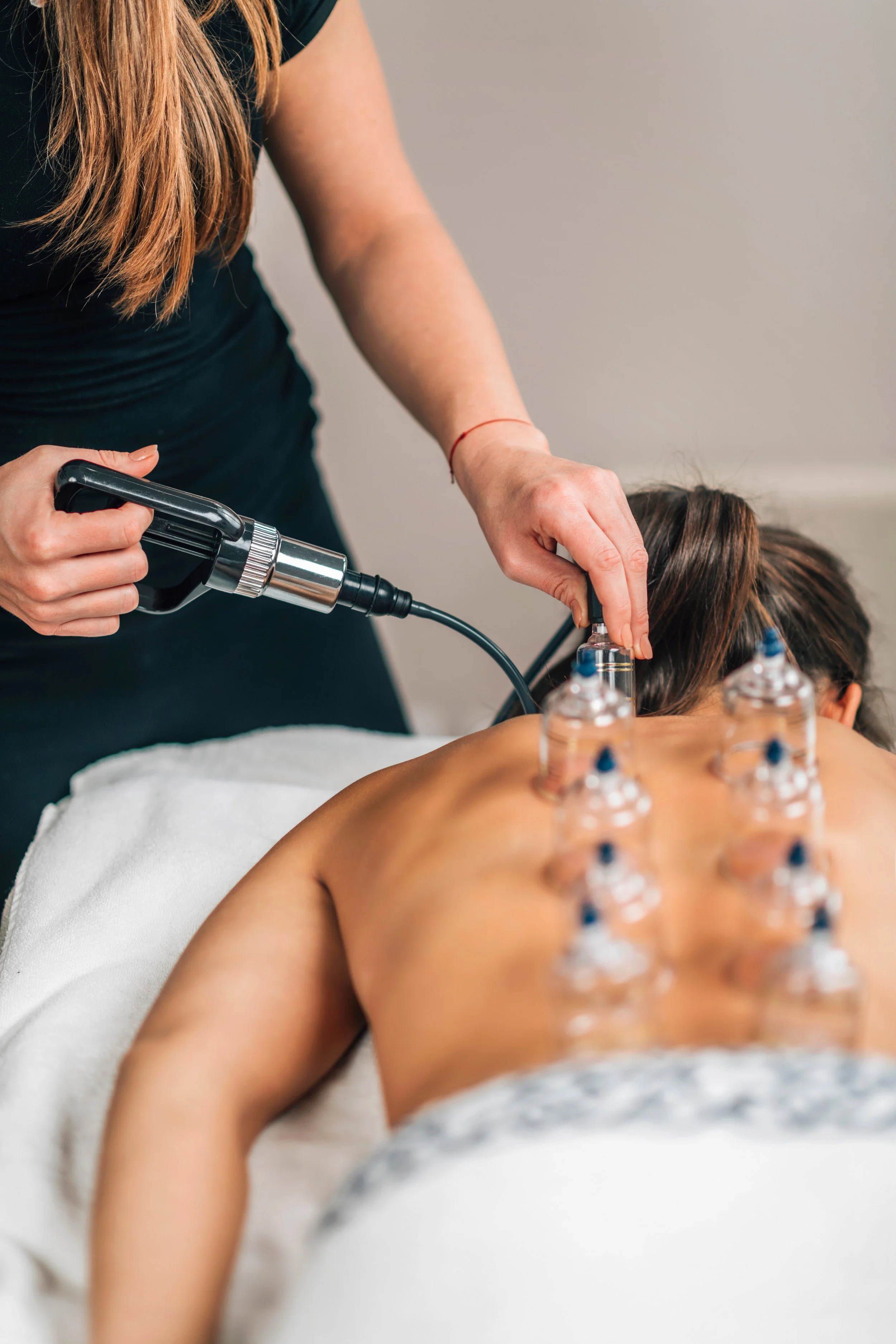 A woman receiving a cupping therapy treatment on her back, with multiple glass cups attached to her skin, while a therapist uses a device on her neck.