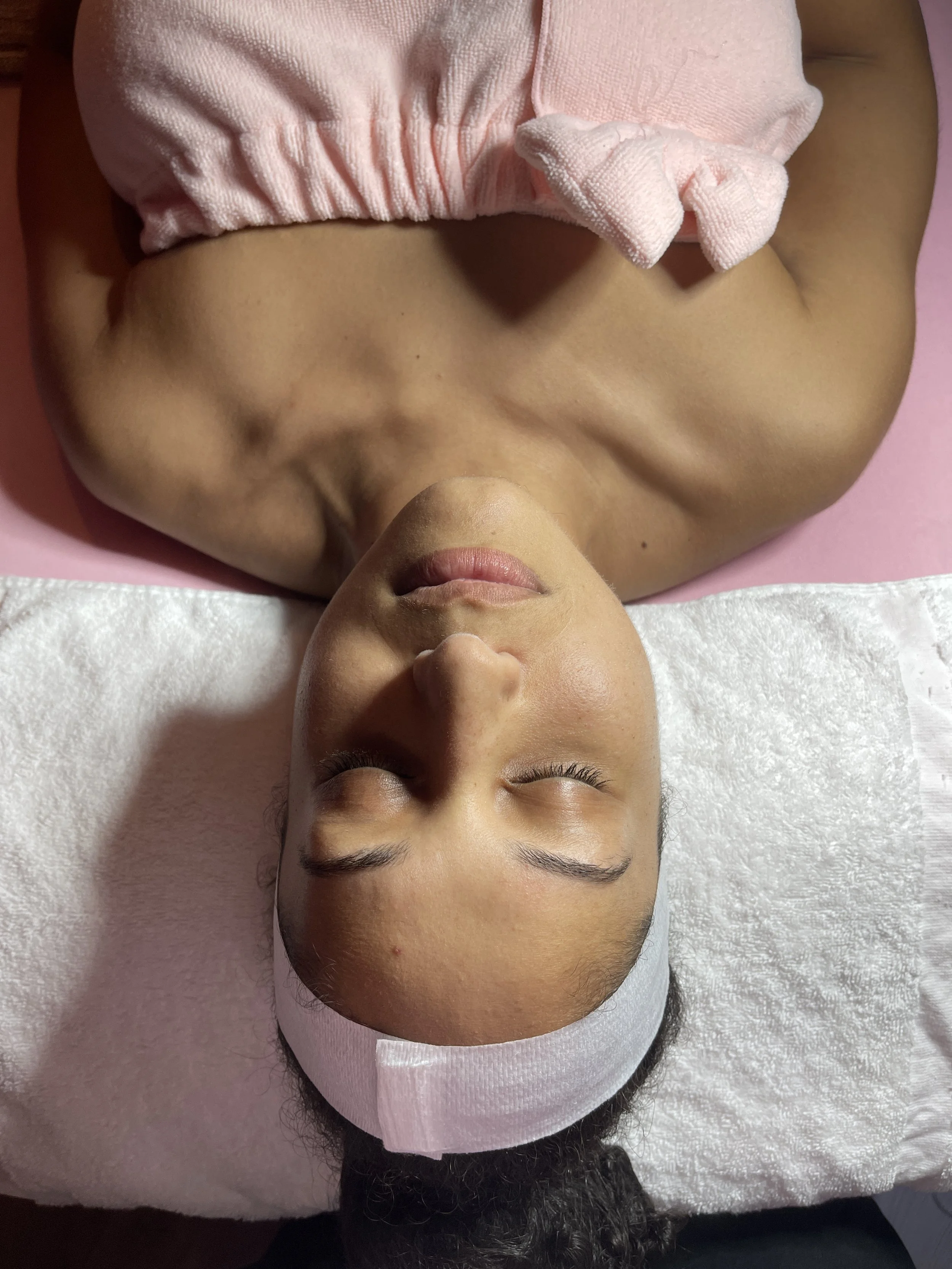 Dermaplaning in Orlando, FL: Everything You Need to Know Before Your First Treatment