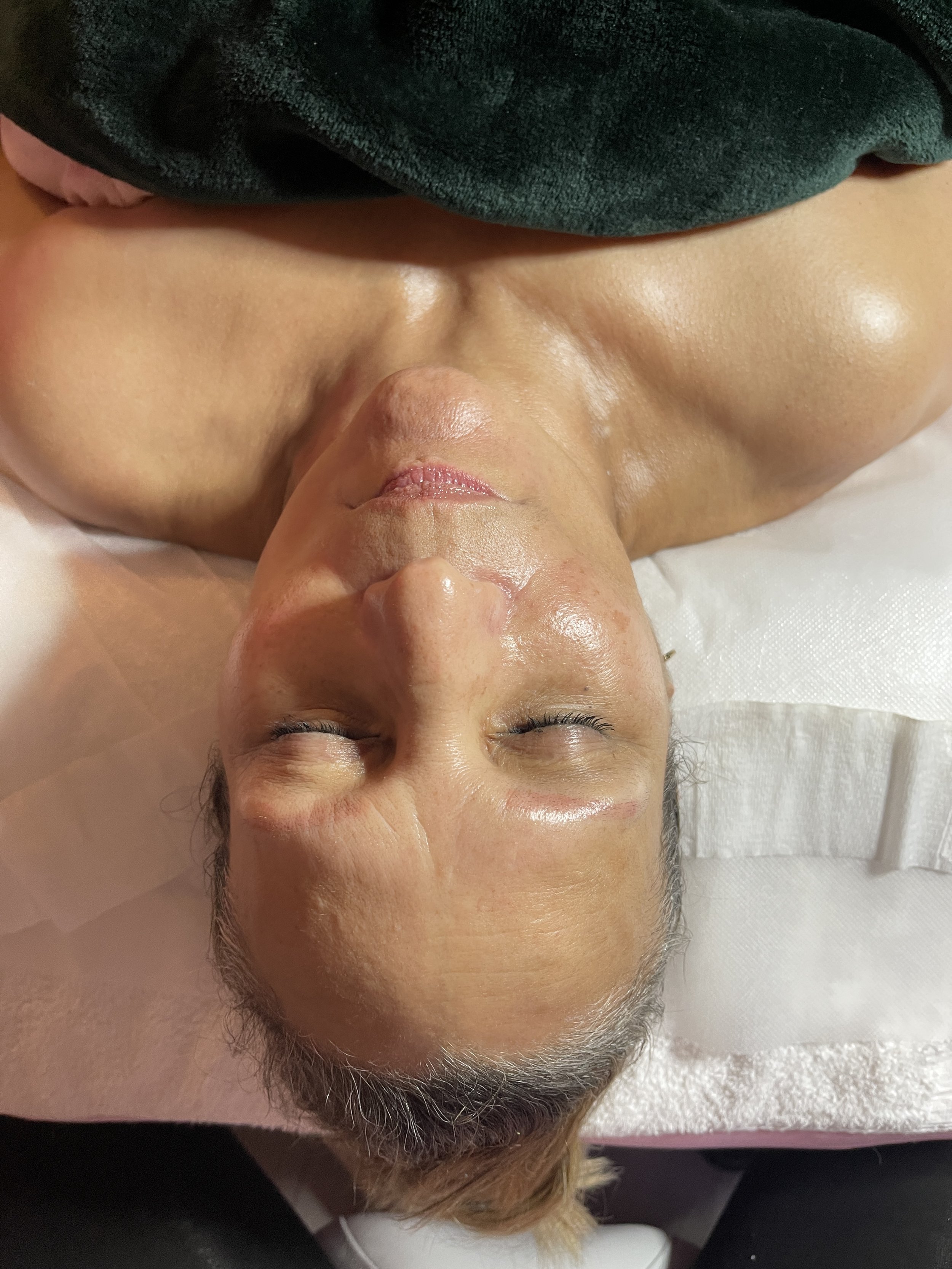 Your Skin Is Telling You It Needs Help: 5 Signs It’s Time to Book a Facial