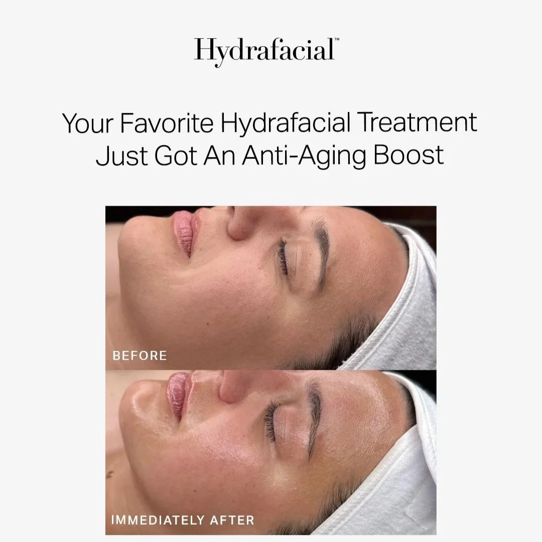 facial, glowing skin, hydrating facial treatment, hydrafacial treatment, orlando hydrafacial, orlando facial, hydro facial, hydra facial, microdermabrasion, wet microdermabrasion, hydrating facial glow facial