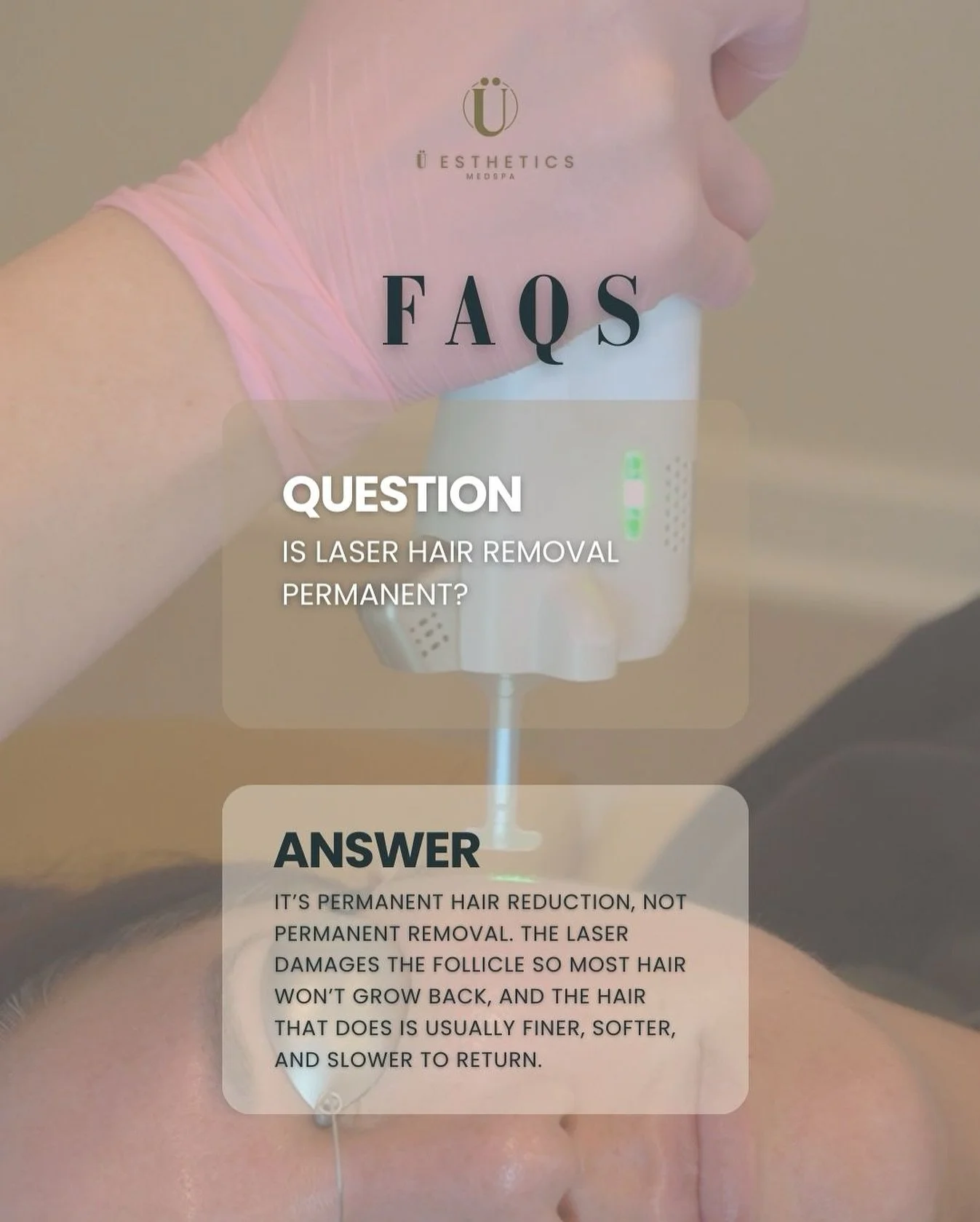 Is laser hair removal permanent? 🤔 
The short answer: It&rsquo;s a permanent hair reduction. By targeting the hair follicle, we help you achieve a significant and lasting decrease in unwanted hair.

Have questions about the process? Send us a DM or 