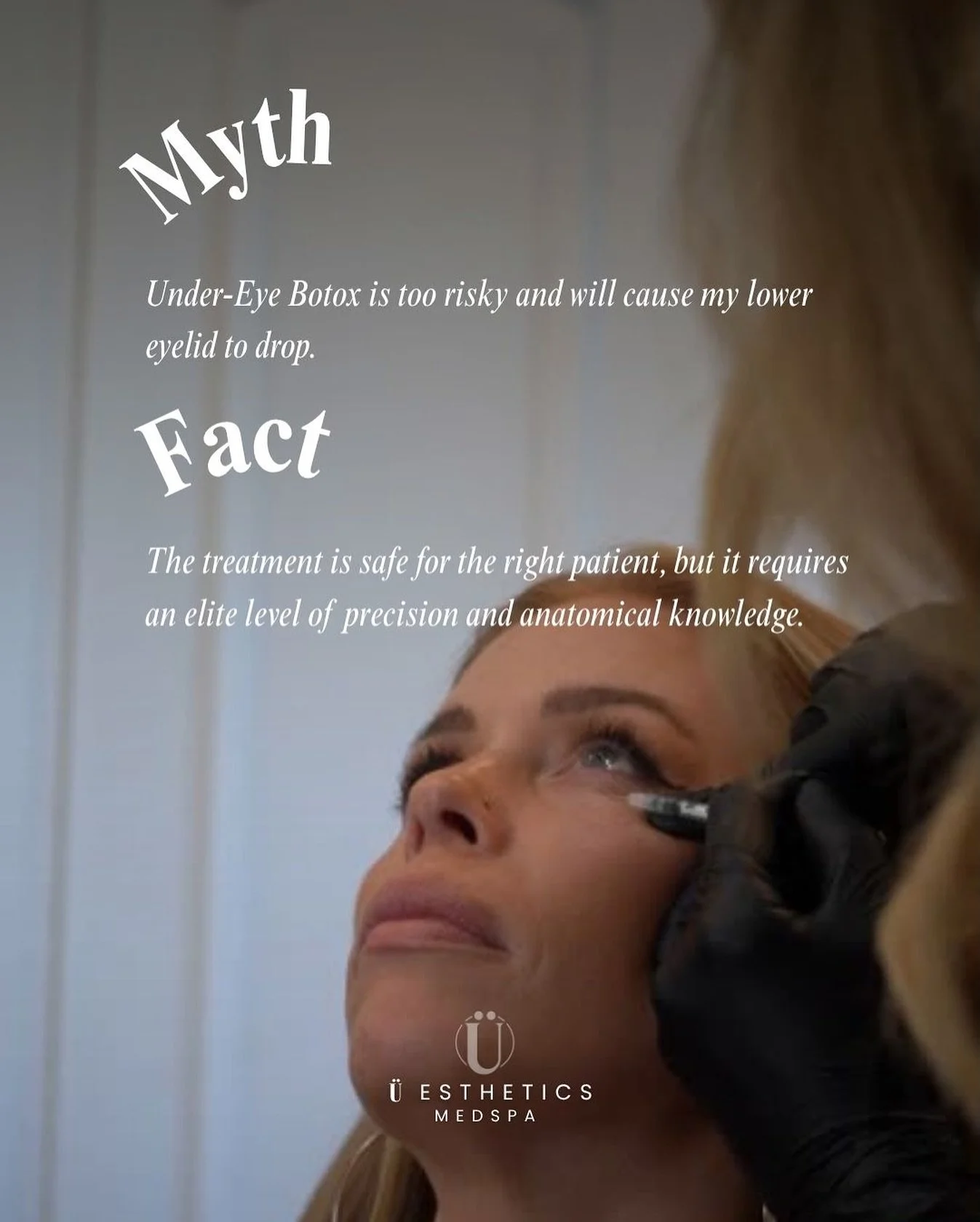 Myth vs. Fact: Can under-eye Botox cause eyelid drop? 🧐 The answer is: Only if done without elite anatomical precision. &nbsp; 

This delicate area requires a micro-dose and extreme skill. We specialize in the precise technique needed to smooth thos