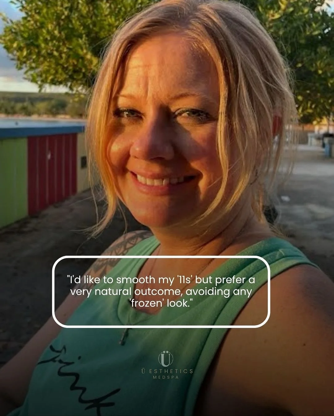 Want to smooth your &lsquo;11s&rsquo;&mdash;but keep your natural expression?
That&rsquo;s what we do best at &Uuml;esthetics: refreshed, never frozen results.

✨ Book your consultation today!